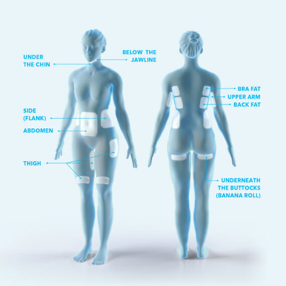 body diagram for coolsculpting areas